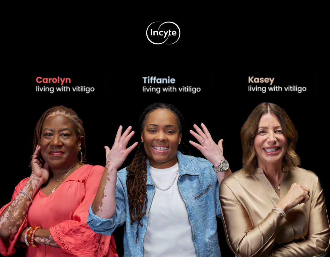 Three women with vitiligo posing against a black background featuring white Incyte logo
