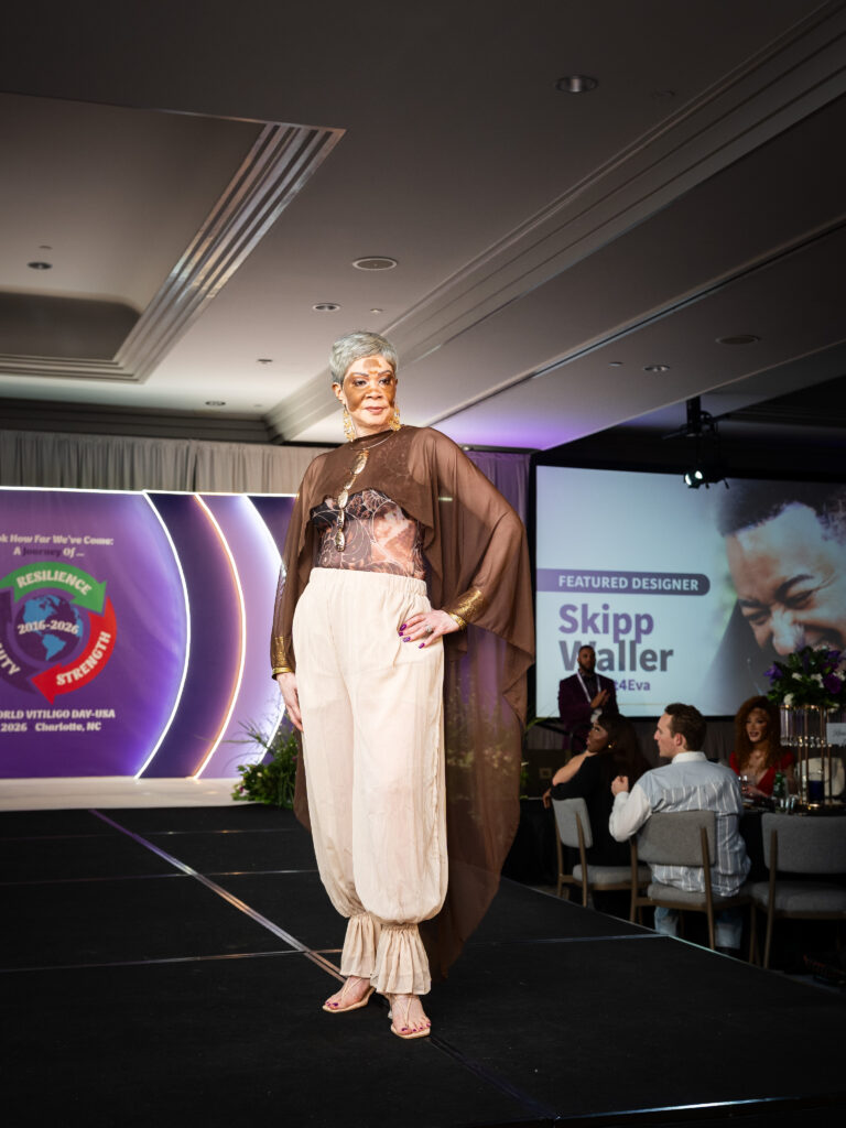 A woman with vitiligo walks the runway as a fashion model