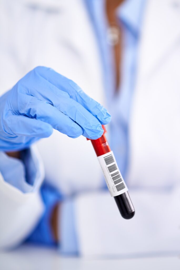 Blood Test